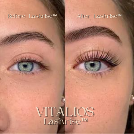 VITALIOS Lashrise™ - Heated Eyelash Curler